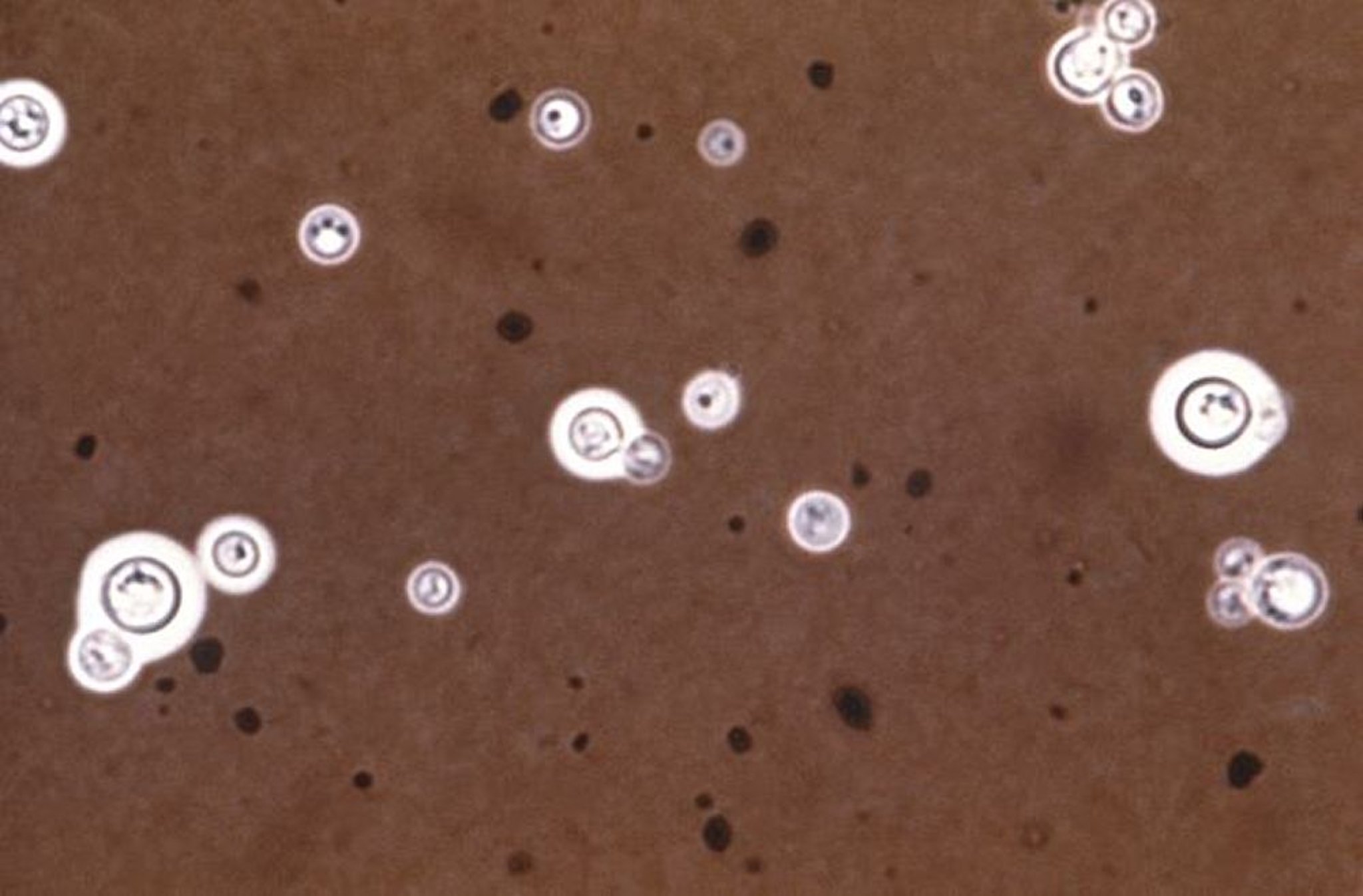Tinta china (<i >Cryptococcus neoformans</i>)