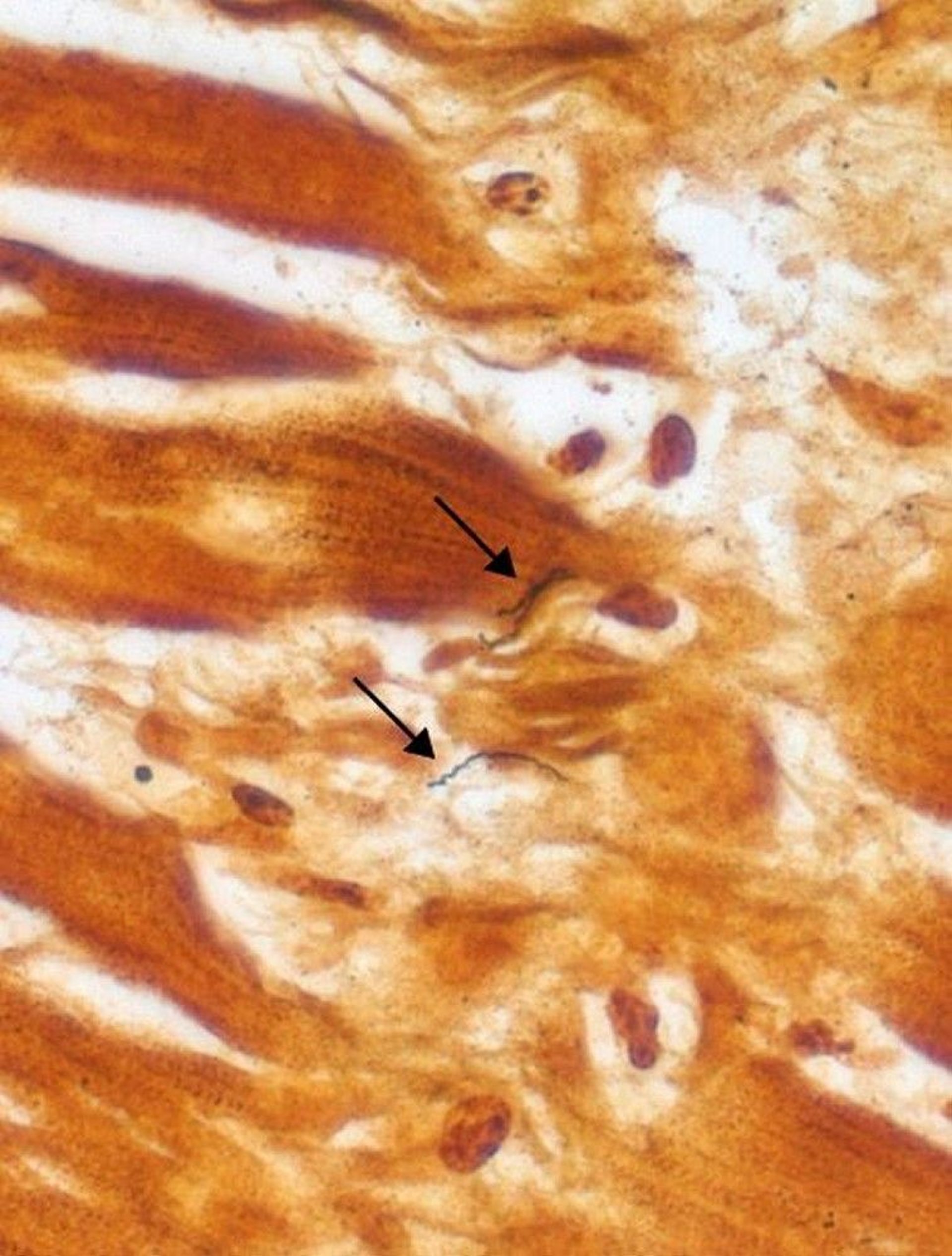 Warthin-Starry Stain (<i >Borrelia burgdorferi</i>)