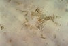 Candida albicans