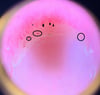 Capillaroscopia