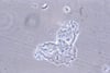 Clue Cells