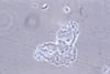 Schlüsselzellen (engl. clue cells)
