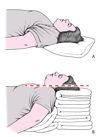 Head and neck positioning to open the airway: Sniffing position