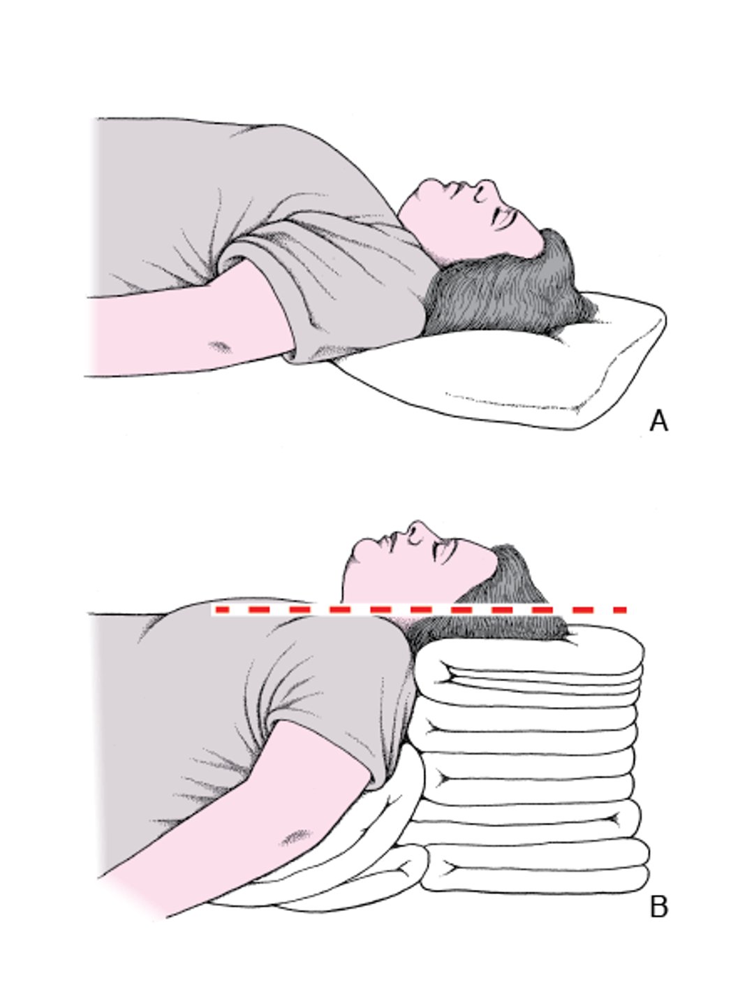 Positionnement de la tête et du cou pour dégager les voies respiratoires