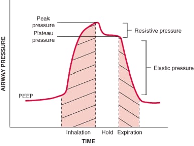 Peep Explained Overview of Mechanical Ventilation - Critical Care Medicine - Merck ...