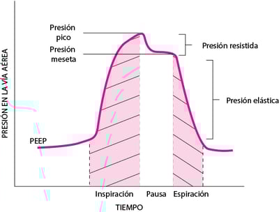 Componentes de la presión de las vías aéreas durante la ventilación mecánica, ilustrados mediante una maniobra de retención inspiratoria