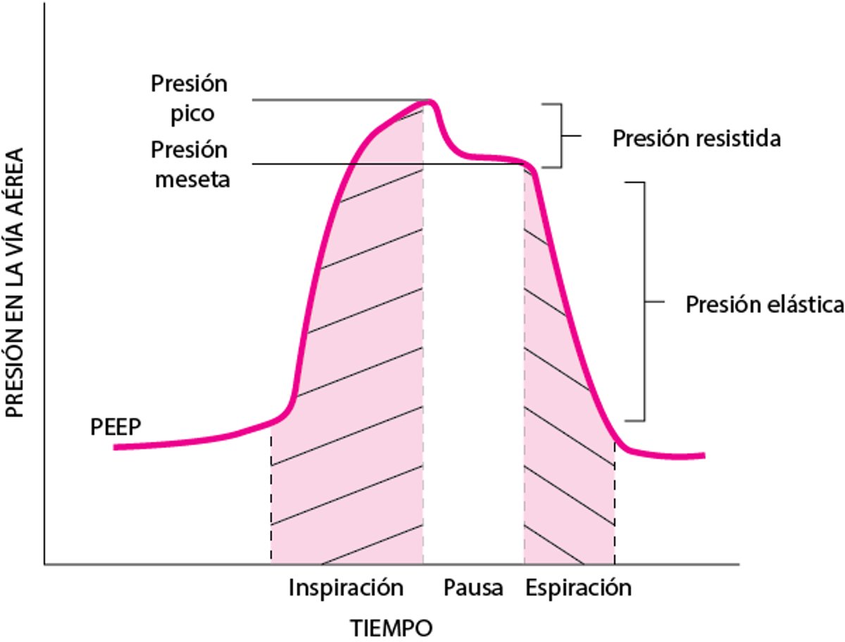 Componentes de la presión de las vías aéreas durante la ventilación mecánica, ilustrados mediante una maniobra de retención inspiratoria