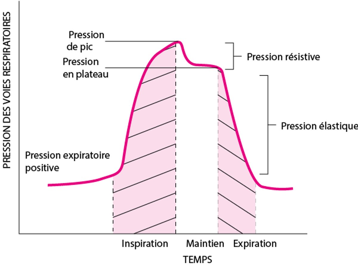 Composantes de la pression des voies respiratoires pendant la ventilation mécanique, illustrée par une manœuvre d'occlusion télé-inspiratoire du circuit expiratoire