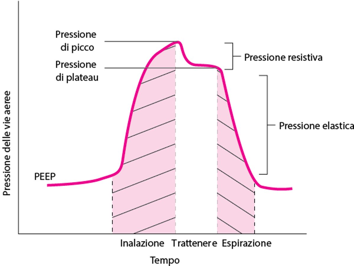 Componenti della pressione delle vie respiratorie in corso di ventilazione meccanica, illustrati con una manovra inspiratoria manuale