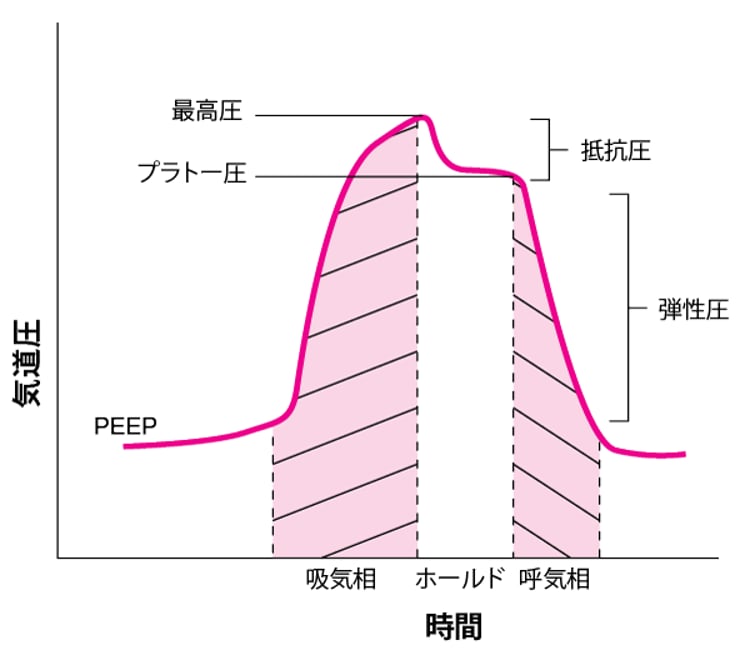 吸気ホールド操作による，機械的人工換気中の気道圧の構成要素の図解