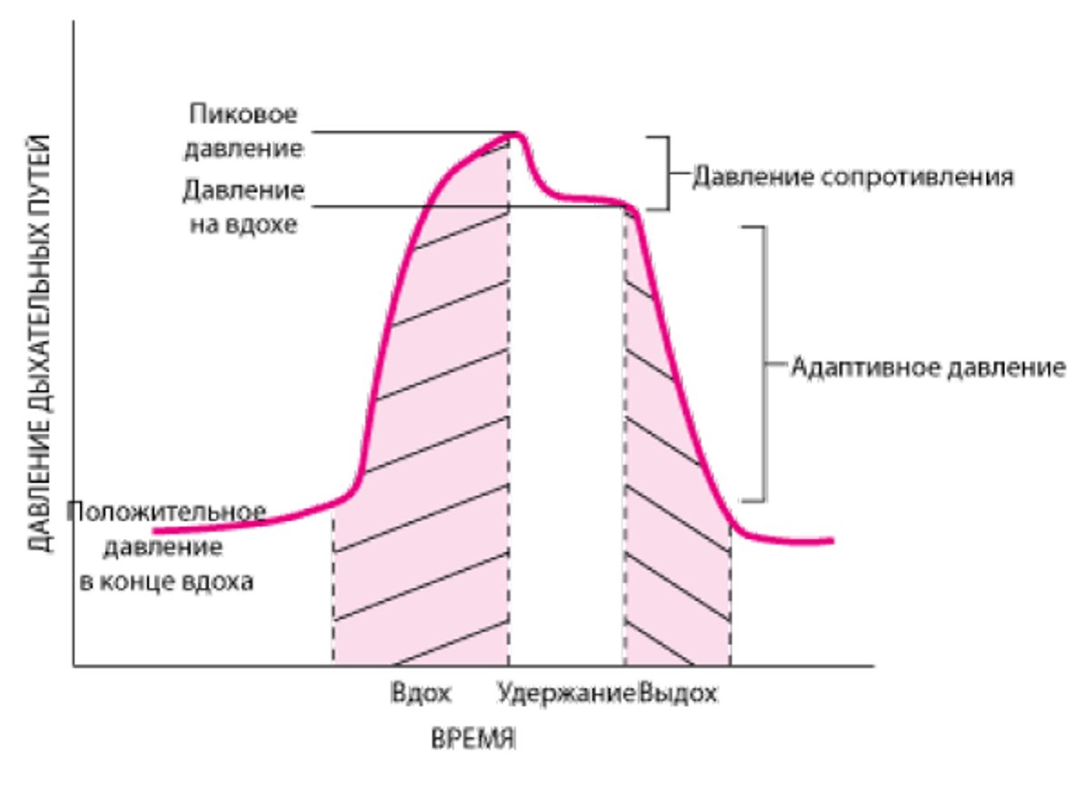 Компоненты давления в дыхательных путях при ИВЛ, демонстрируемые с помощью инспираторной паузы