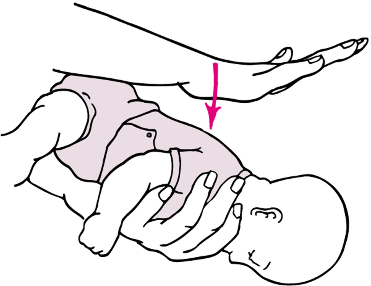 Schläge auf den Rücken – Kind