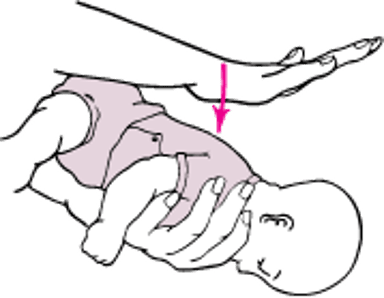 Хлопки по спине у младенцев