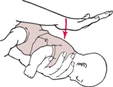 Vỗ lưng – Trẻ sơ sinh