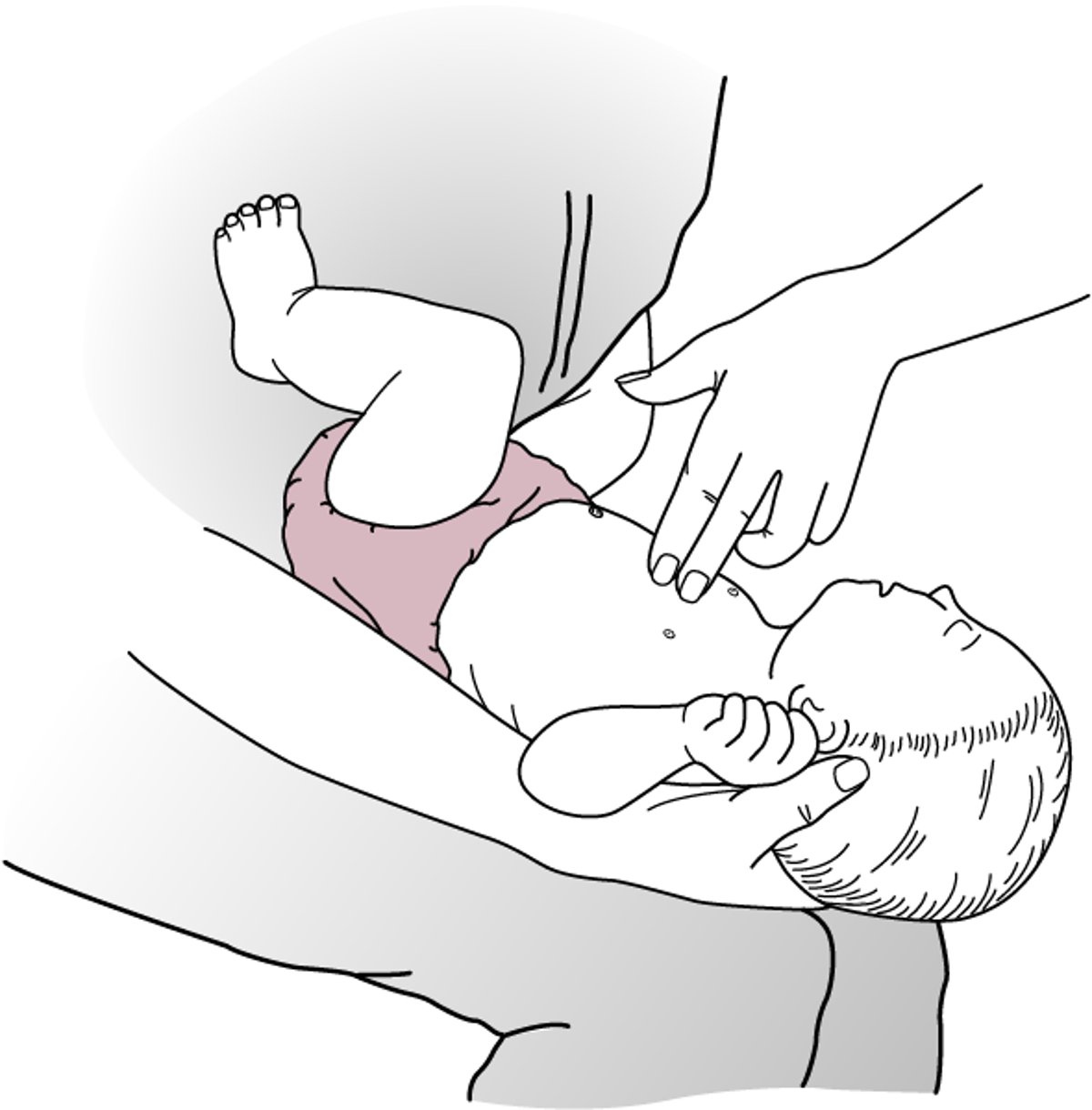 Compressioni toraciche, lattante