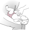 胸部突き上げ法―乳児