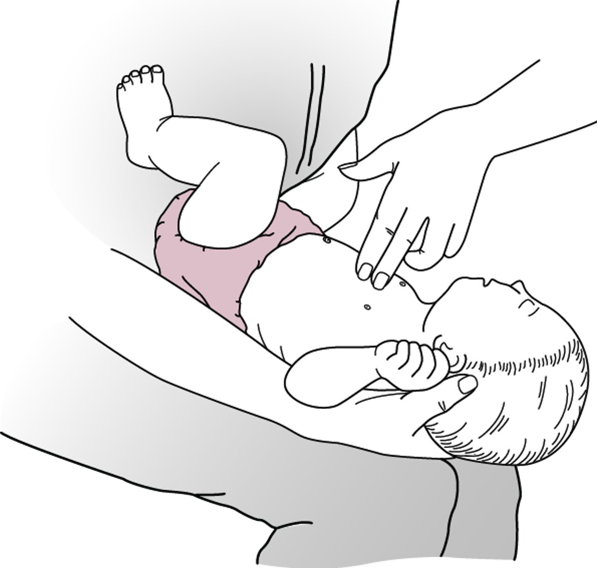 胸部突き上げ法―乳児