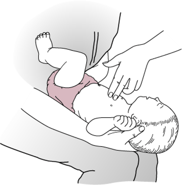 胸部突き上げ法―乳児