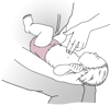 Đẩy ngực – Trẻ sơ sinh