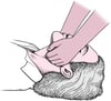Jaw Thrust