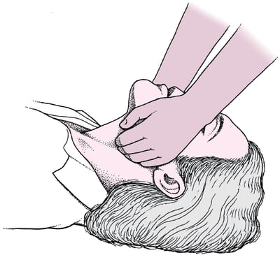 Empuje de la mandíbula