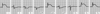 急性左室側壁梗塞（発症後数時間以内に記録された波形）