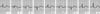 Inferior (Diaphragmatic) Left Ventricular Infarction (after the first 24 hours)