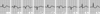 左室下壁（横隔膜側）梗塞（発症から24時間後）