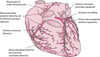 Arterias del corazón
