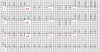 Fibrilação atrial