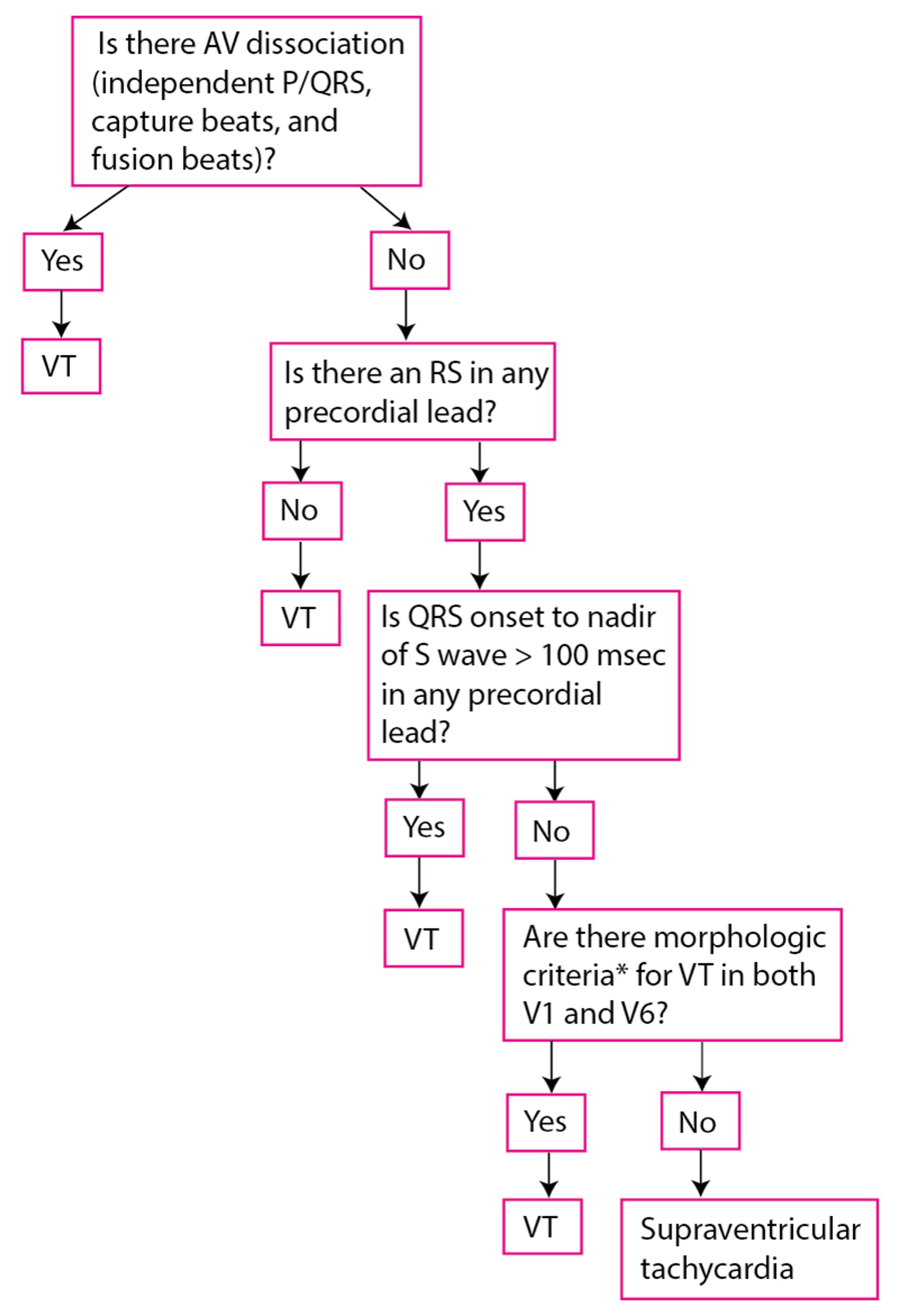 Modified Brugada Criteria for Ventricular Tachycardia