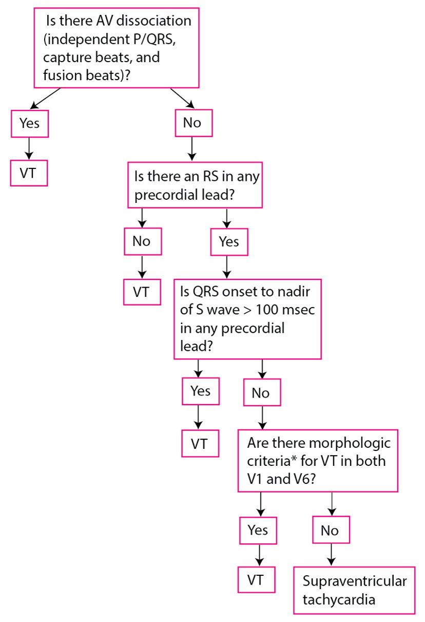 Image:Modified Brugada criteria for ventricular tachycardia-MSD Manual ...