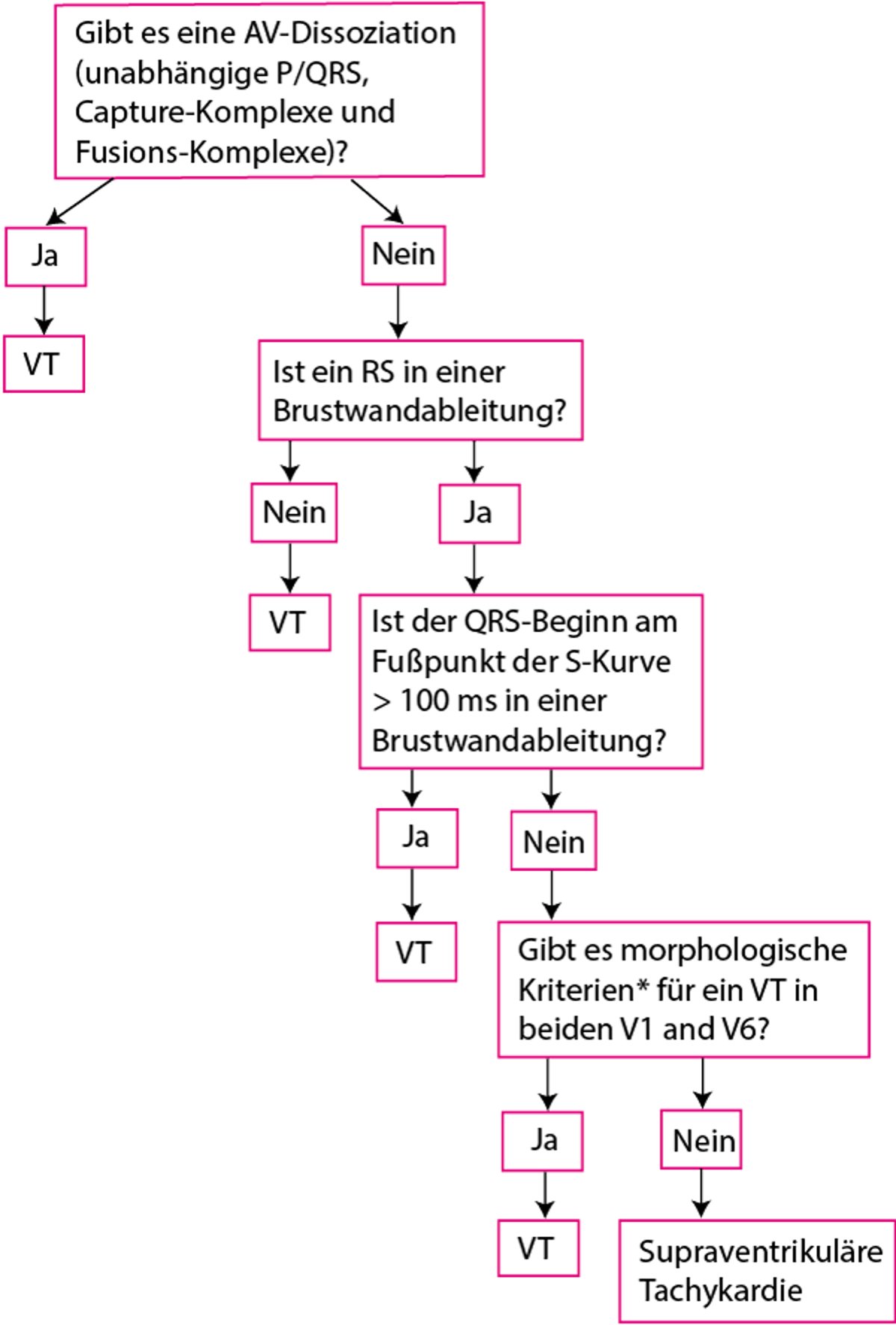 Modifizierte Brugada-Kriterien für ventrikuläre Tachykardie
