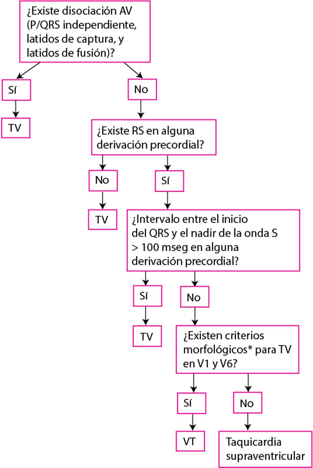 Criterios de Brugada modificados para la taquicardia ventricular