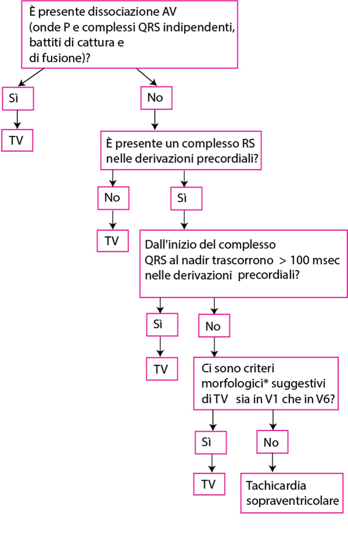 Criteri di Brugada modificati per la tachicardia ventricolare