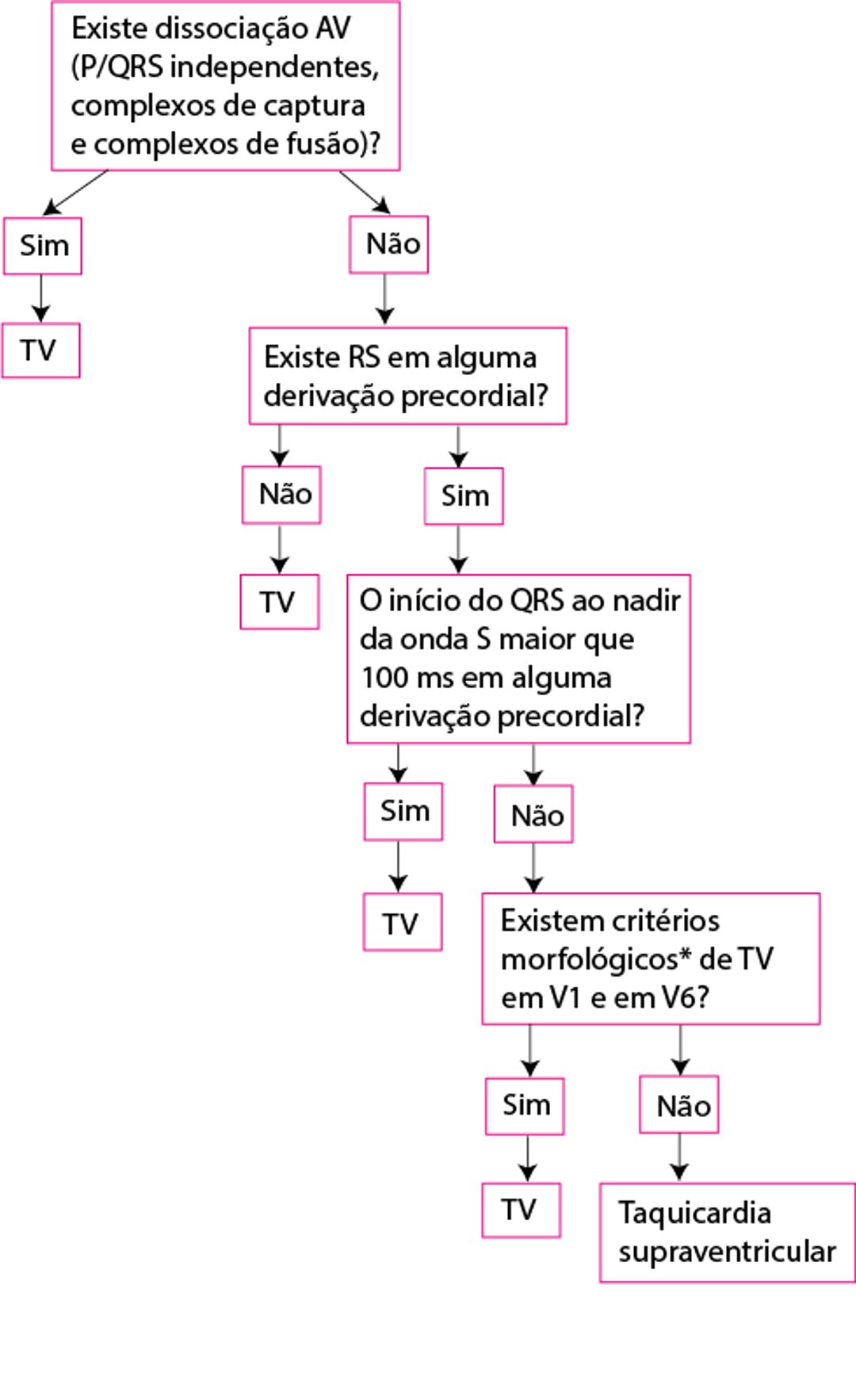 Critérios de Brugada modificados para taquicardia ventricular