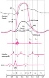 Diagramm der Herzzyklus mit Druckkurven der Herzkammern, Herztöne, Jugularvenenpulswelle und EKG