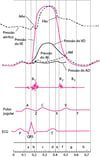 Diagrama do ciclo cardíaco, mostrando as curvas pressóricas das câmaras cardíacas, bulhas cardíacas, onda de pulso jugular e ECG