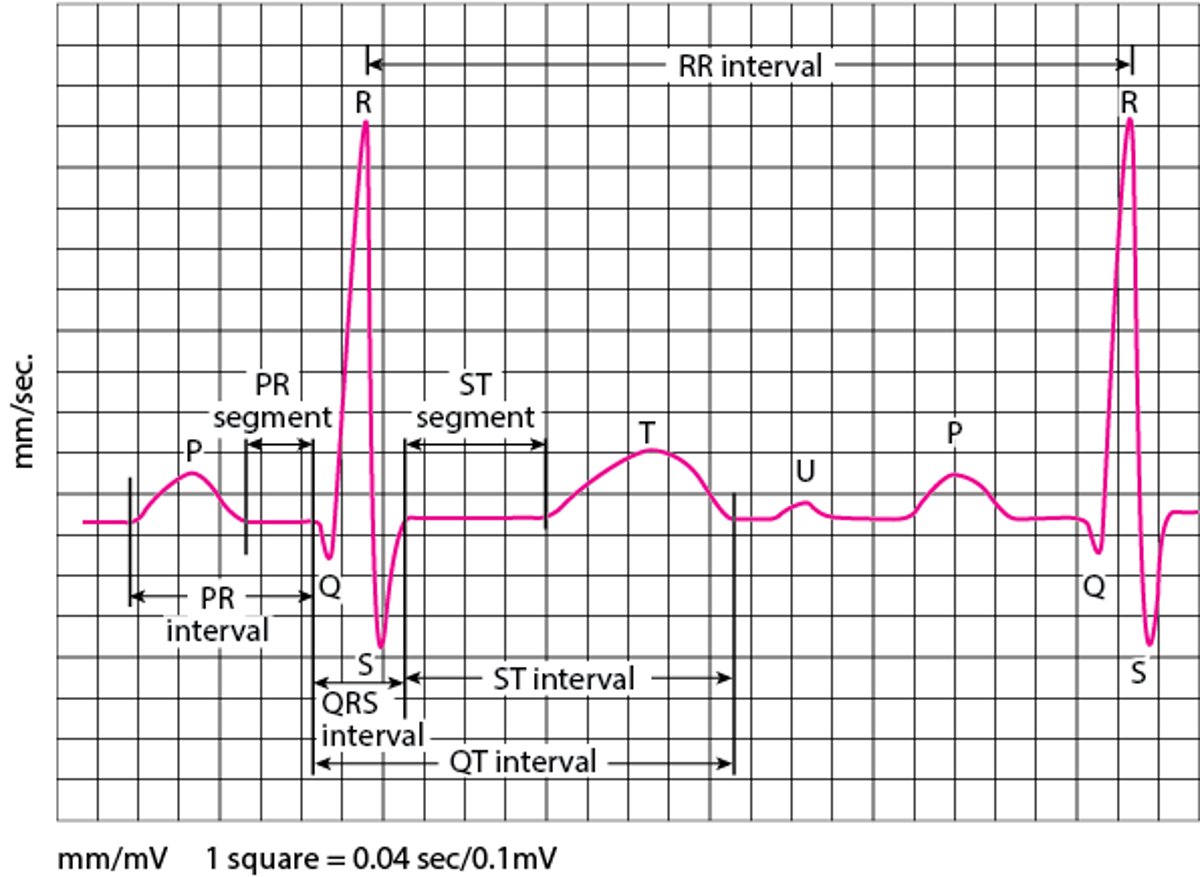 Electrocardiography (ECG) waves