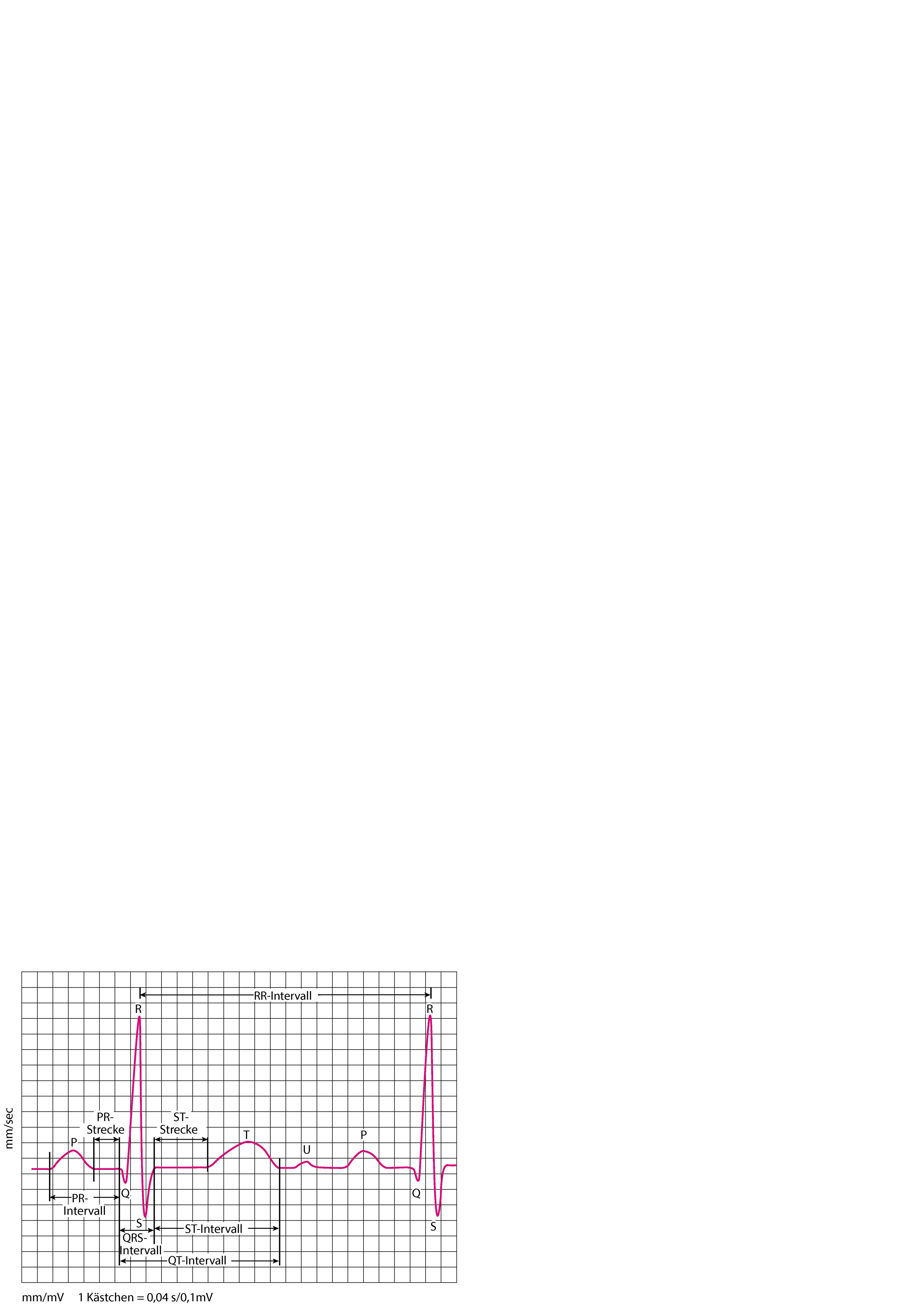 Elektrokardiographie (EKG)-Wellen