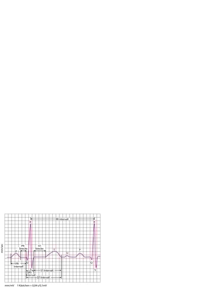 Elektrokardiographie (EKG)-Wellen