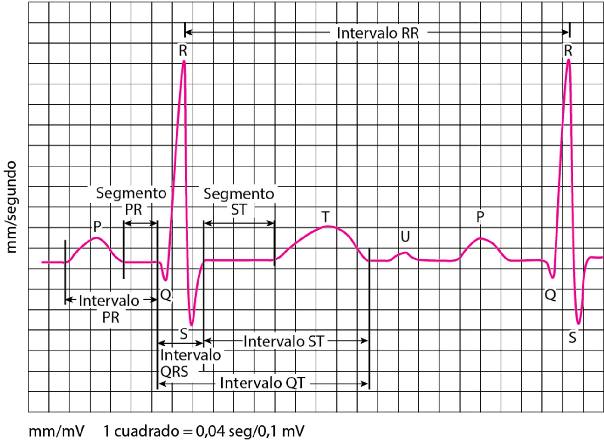 Ondas de electrocardiografía (ECG)