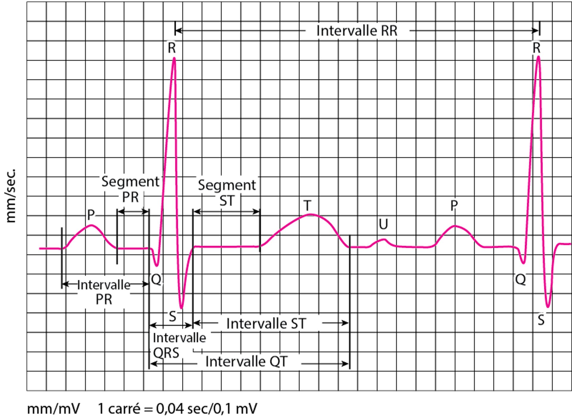 Ondes d'électrocardiographie (ECG)