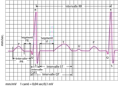 Ondes d'électrocardiographie (ECG)