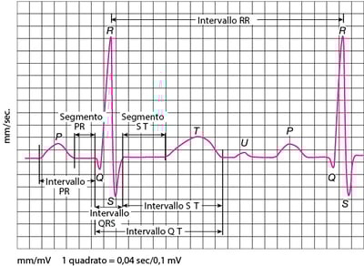 Onde elettrocardiografiche (ECG)