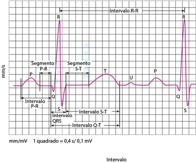 Ondas de eletrocardiografia (ECG)