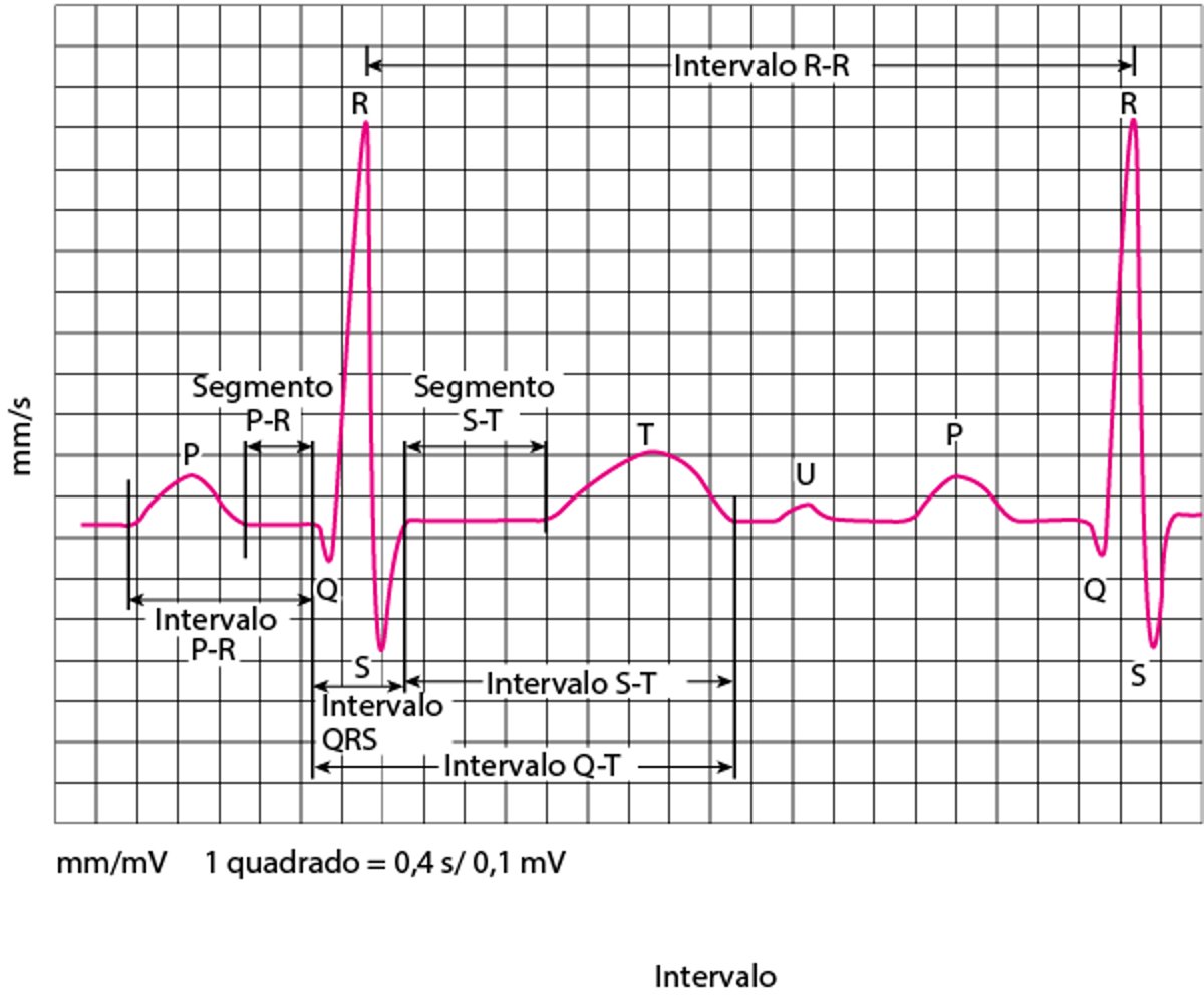 Ondas de eletrocardiografia (ECG)