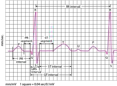 心电图 （ECG）波形