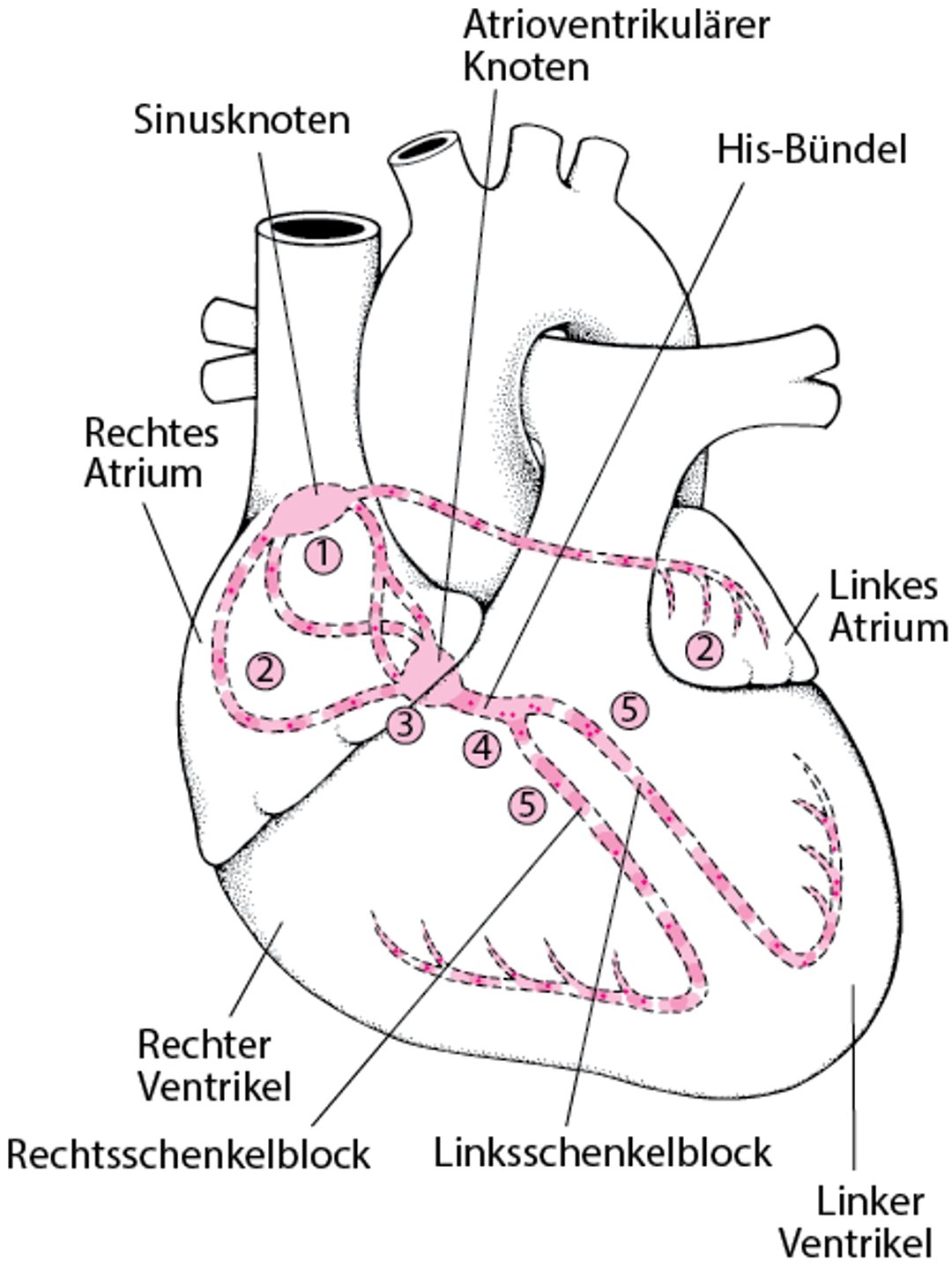 Elektrische Weg durch das Herz