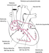 Vía eléctrica a través del corazón